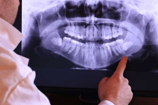Best Emergency Care for Gum Disease in Oakland, OR